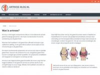 Artrose-Blog.nl - Alles over artrose